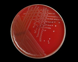 e.faecalis on blood agar